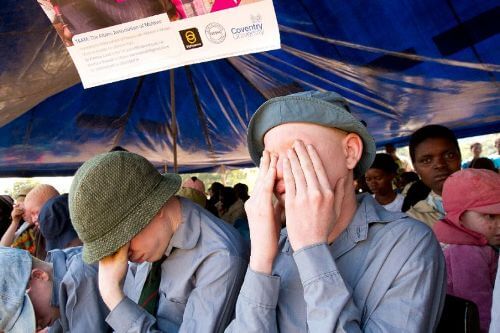 Thugs attack albino man in Chikhwawa
