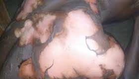 Nkhotakota woman arrested for gruesomely pouring hot water on husband after a family dispute