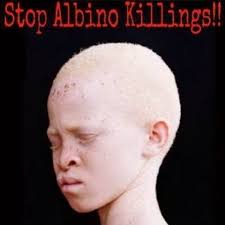 Man arrested for defiling albino girl in Phalombe