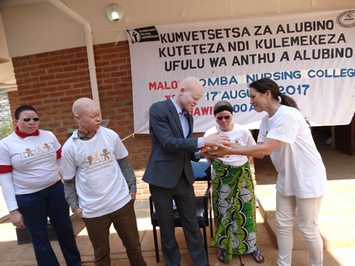 APAM calls for more support for People with albinism