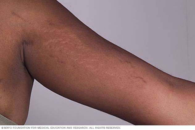 Ghanaian Immigration Services disqualifies candidates with bleached skin