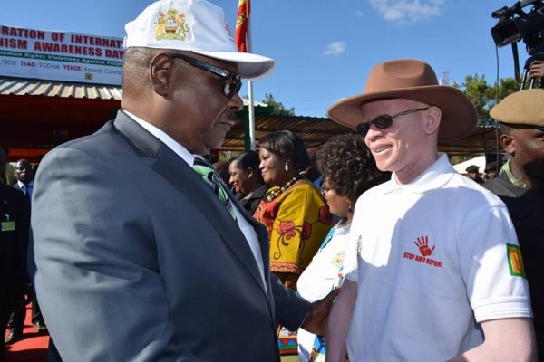 This is a crisis: One person with albinism killed is one too many