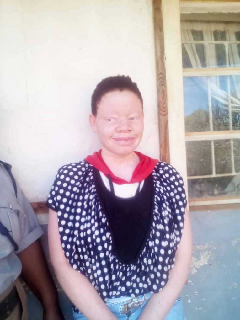 No new leads on whereabouts of a 12 year old boy with albinism who went missing in Phalombe