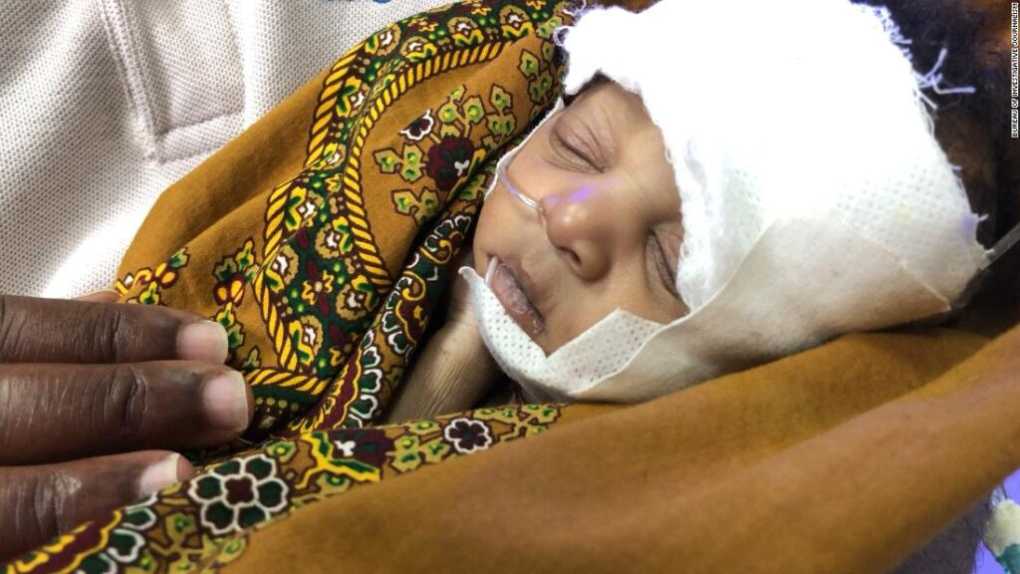 How drug resistant bacteria is killing Malawian babies