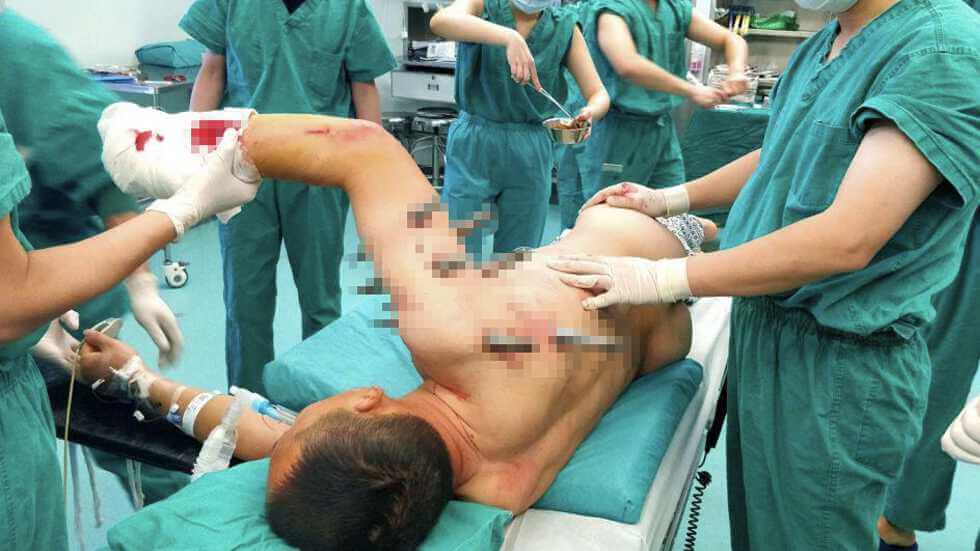 Man of steel: Chinese factory worker miraculously survives being impaled on spikes