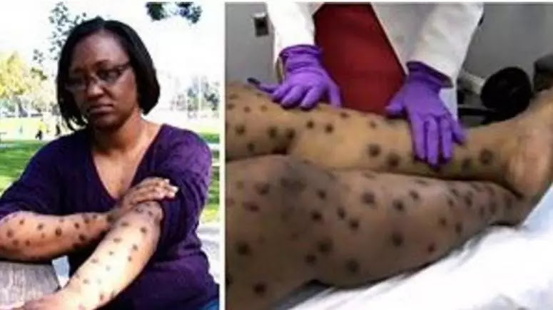 Bizarre; Nigerian woman turns into ‘leopard’ after trying to bleach her skin
