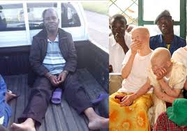 Catholic priest Muhosha suspected poisoned in Prison, critically ill; Malawi’s albinism crisis