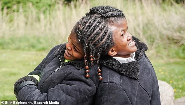 Netherlands’s conjoined twin sister defeats doctor prediction that will die at 10…are now 18 year