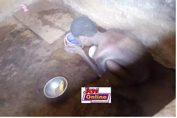 Ghanaian boy locked indoors for 20 years due to medical condition