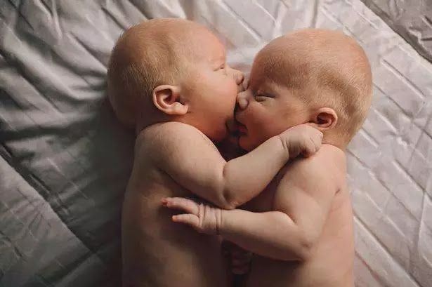 USA’s Arizona family move 3,000 miles to save twin boys who can’t be outside more than 45 mins