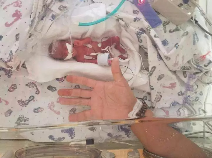 USA’s California mother gives birth to miracle 13-ounce baby born at 23 weeks