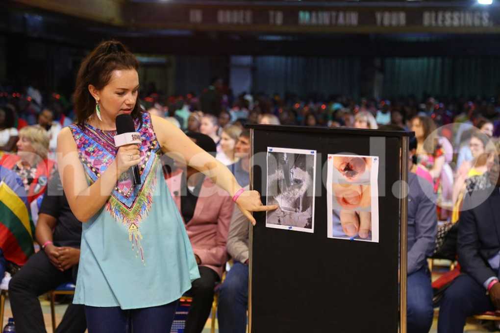 “I no longer eat wet cement, my foot abscess is gone” testifies woman at Prophet TB Joshua’s SCOAN
