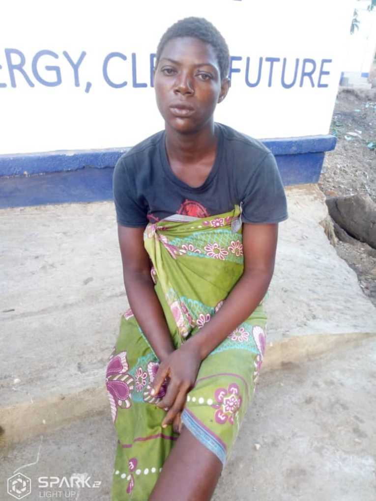 Malawi’s Chikwawa woman burns son’s hands over velvet bean (Kalongonda)