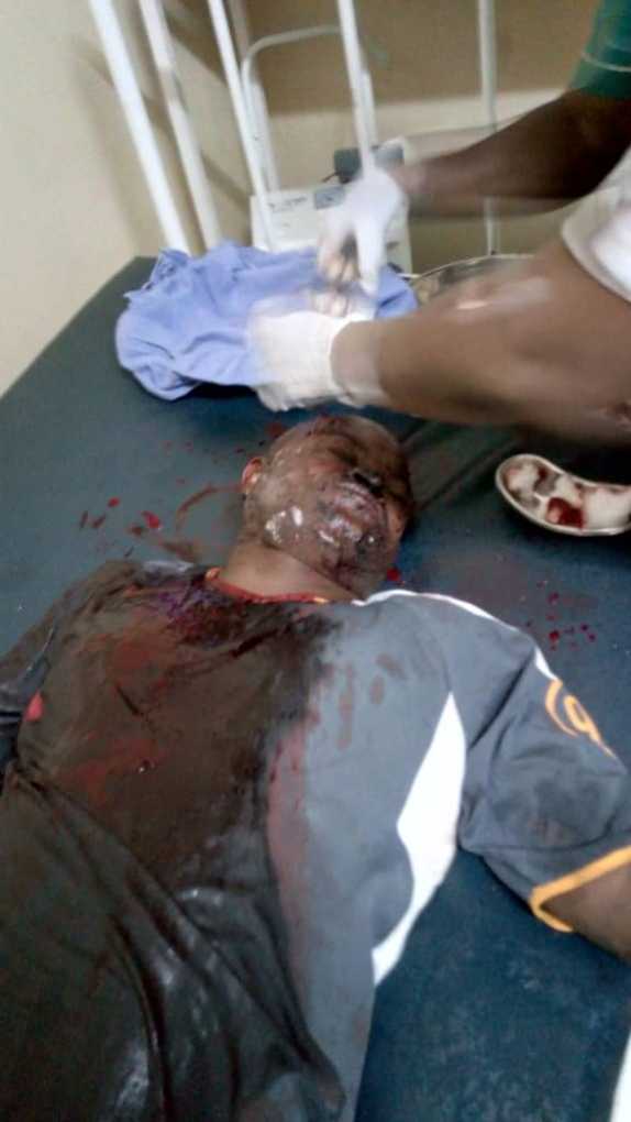Malawi senior army officers hack each other with panga over beer