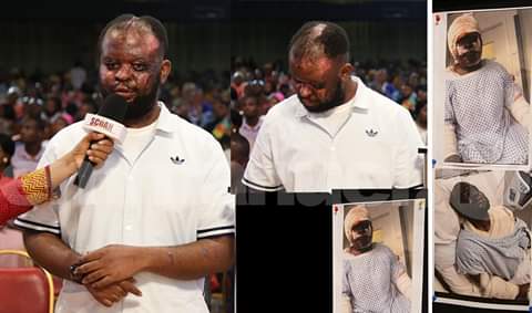 Prophet TB Joshua healing power: Rescues man from gruesome acid attack