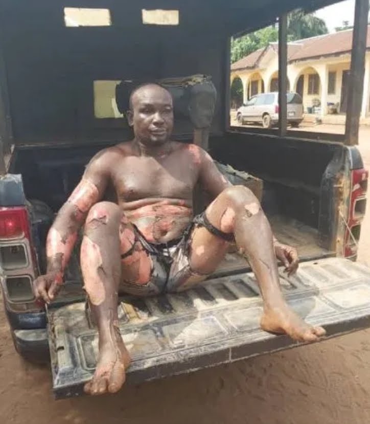 Nigerian man arrested for stabbing his mother, set himself and mother ablaze