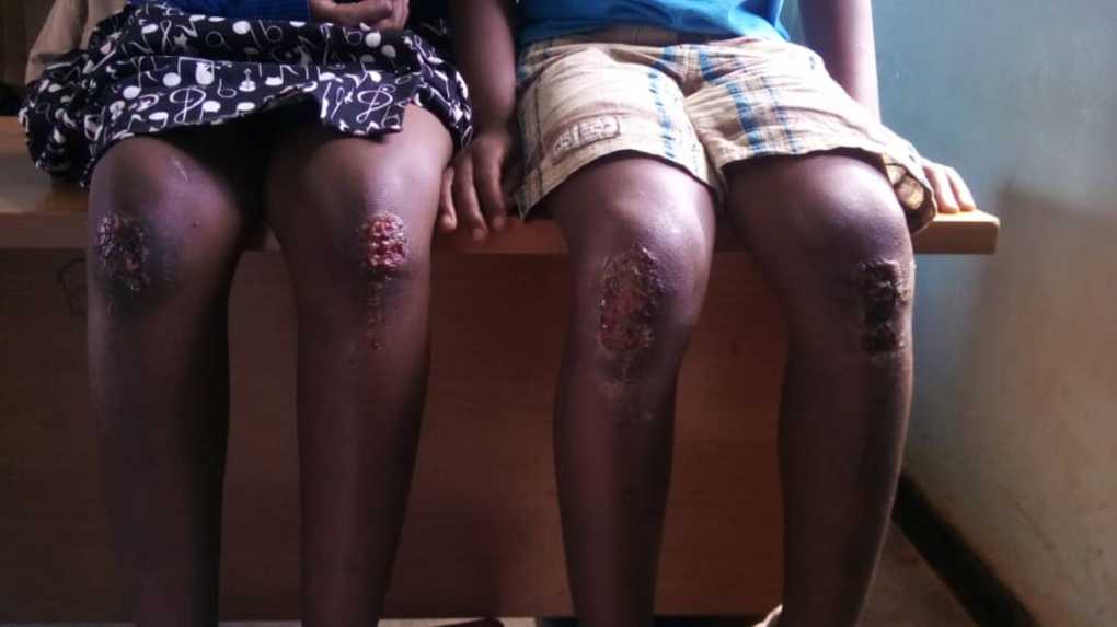 Rwandan woman in Malawi slapped with 3 year jail term for bodily harming step children
