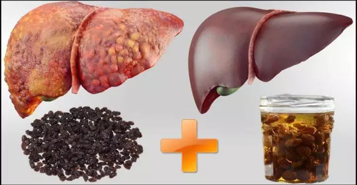 Tips: Check out for foods that damage person’s liver