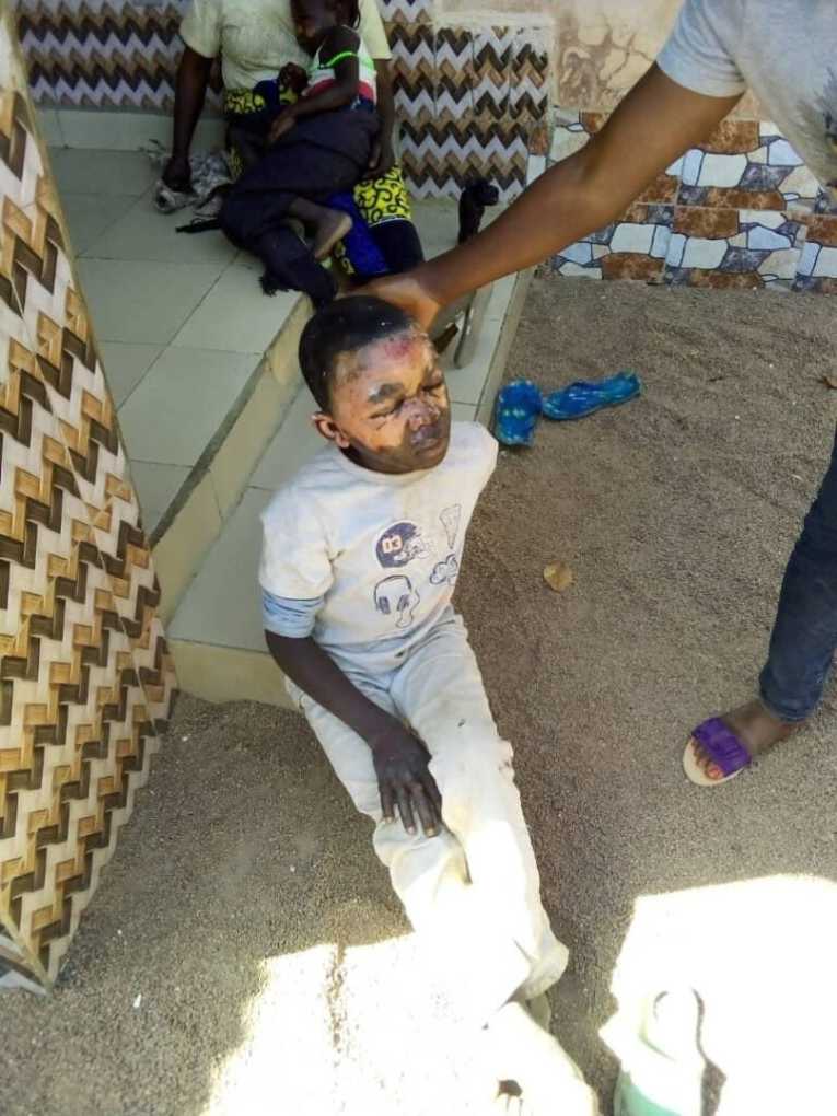 Children Burnt for Witchcraft in Central Nigeria