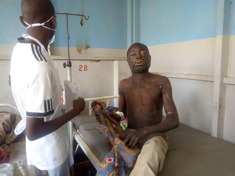 Malawian woman scalds husband with hot porridge
