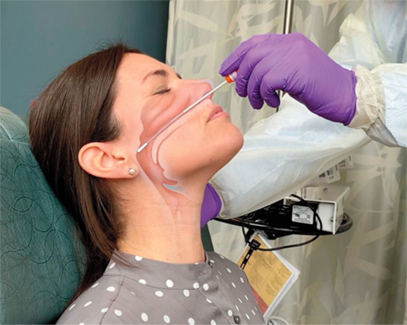 COVID-19 nasal swab test causes brain fluid leak in US woman