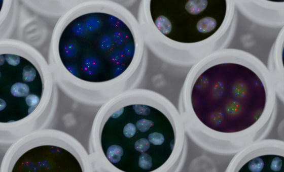 UN reports ‘leap forward’ in regulating DNA-altering technology to benefit all