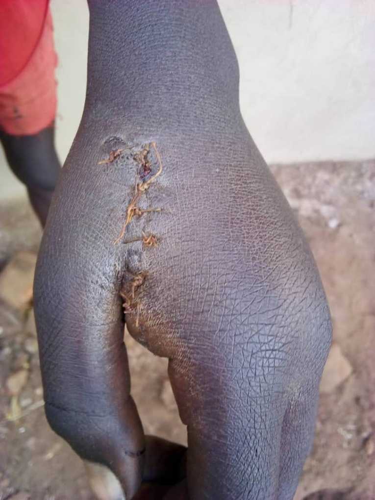 Heartless Malawi’s Mangochi police officers brutally hack teenage boy while in cell