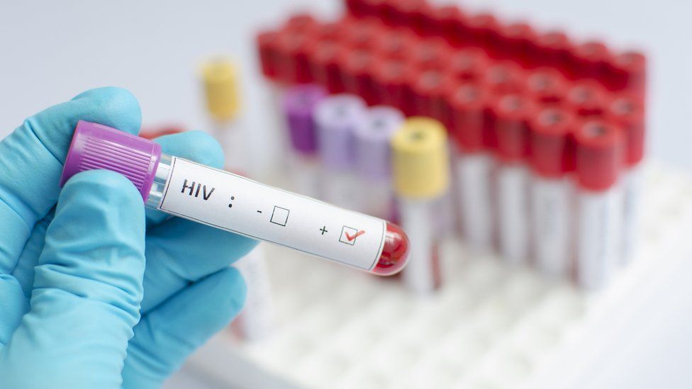 No hope for HIV/AIDS vaccine soon: As Johnson & Johnson, Global Partners study shows 25.2% efficacy rate