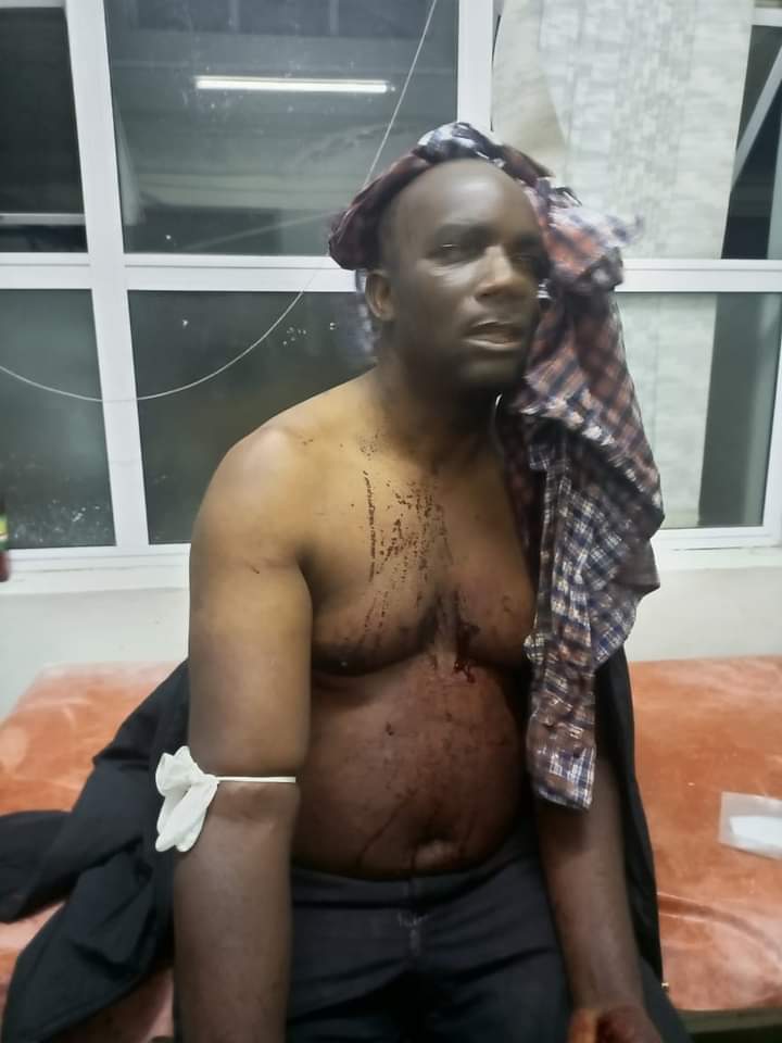 Unknown thugs hack Opposition DPP Southern Region Governor Charles Mchacha