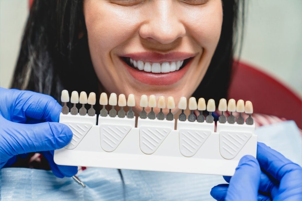 Full Mouth Dental Implants