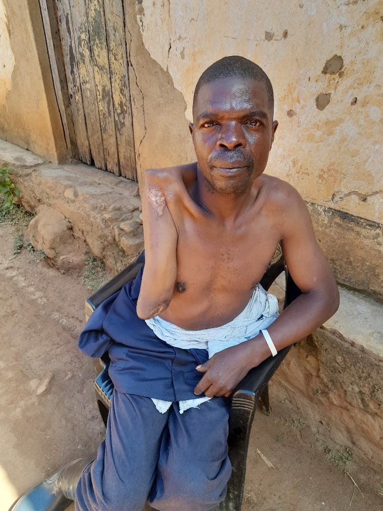 Naming’omba Tea Estates abandons employee Kennedy Jamali after disabled on duty