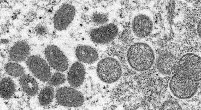 Europe: WHO supporting countries affected by rare monkeypox outbreak