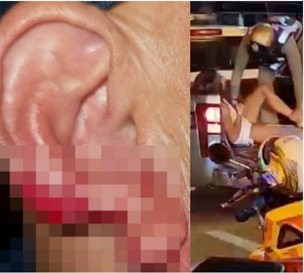 Thailand drunkard prostitute bites off tourist’s ear before swallowing it in front of him