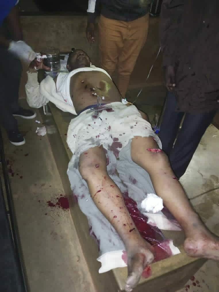 Grenade explosion shocks Dzaleka camp residents