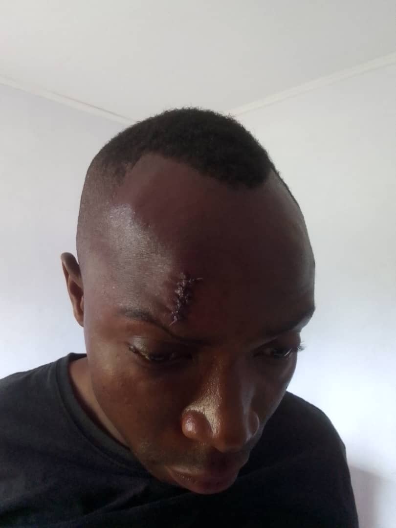 MDF soldier Maxon Job Phiri caught fighting with sex worker over unsettled bill