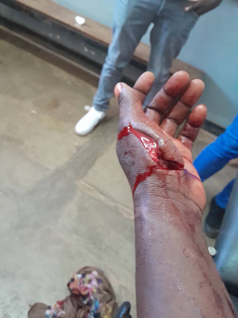 Chaos erupts in Lilongwe as civil servants’ protest turns violent