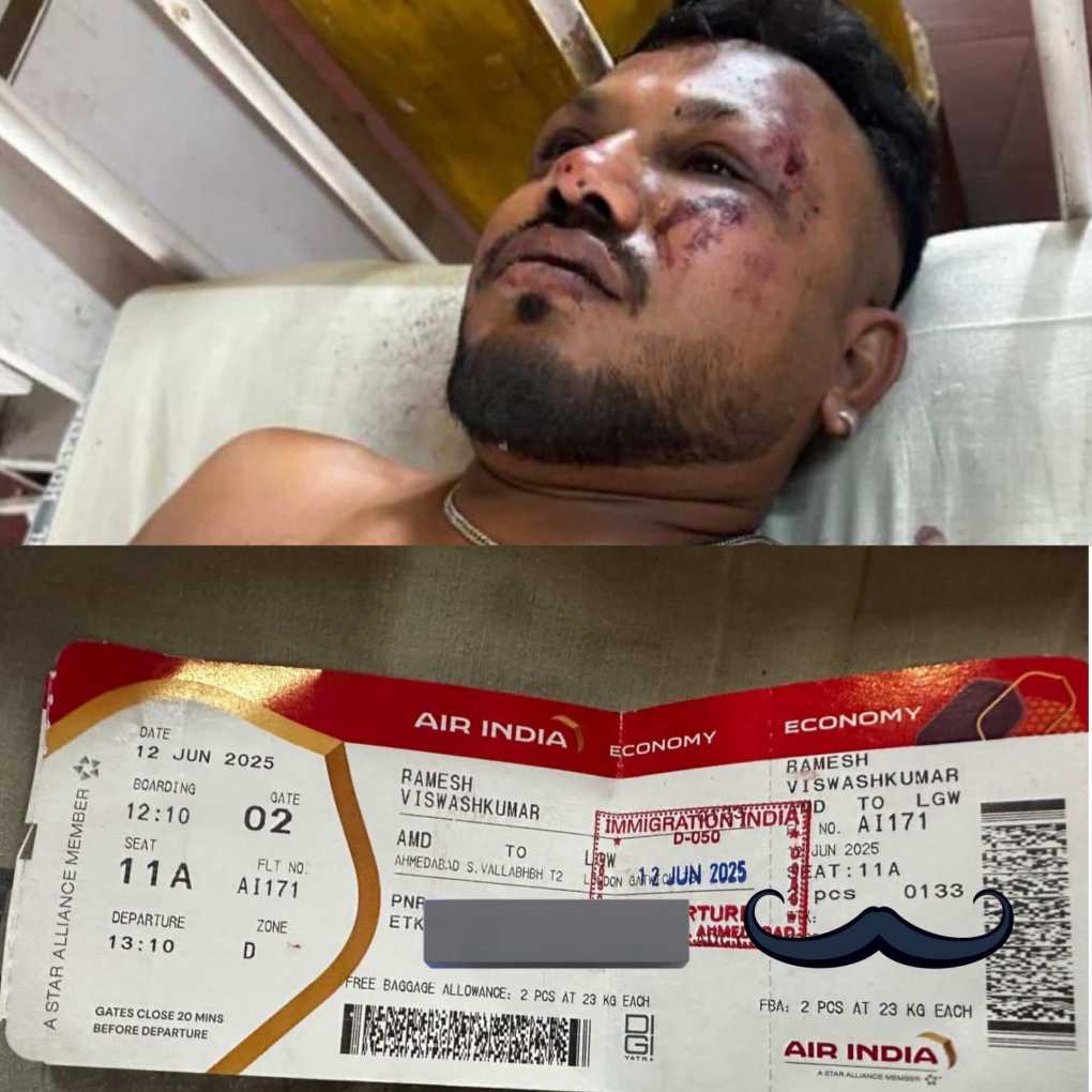 Miracle amid tragedy: British national survives from Indian plane crash
