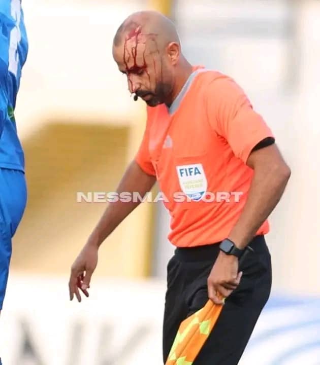 Tunisian League 1 match abandoned after referee Marwane Saad injured with fans object