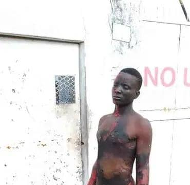 Vandal suspect electrocuted in Blantyre