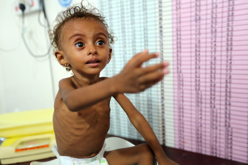 Yemen Hunger