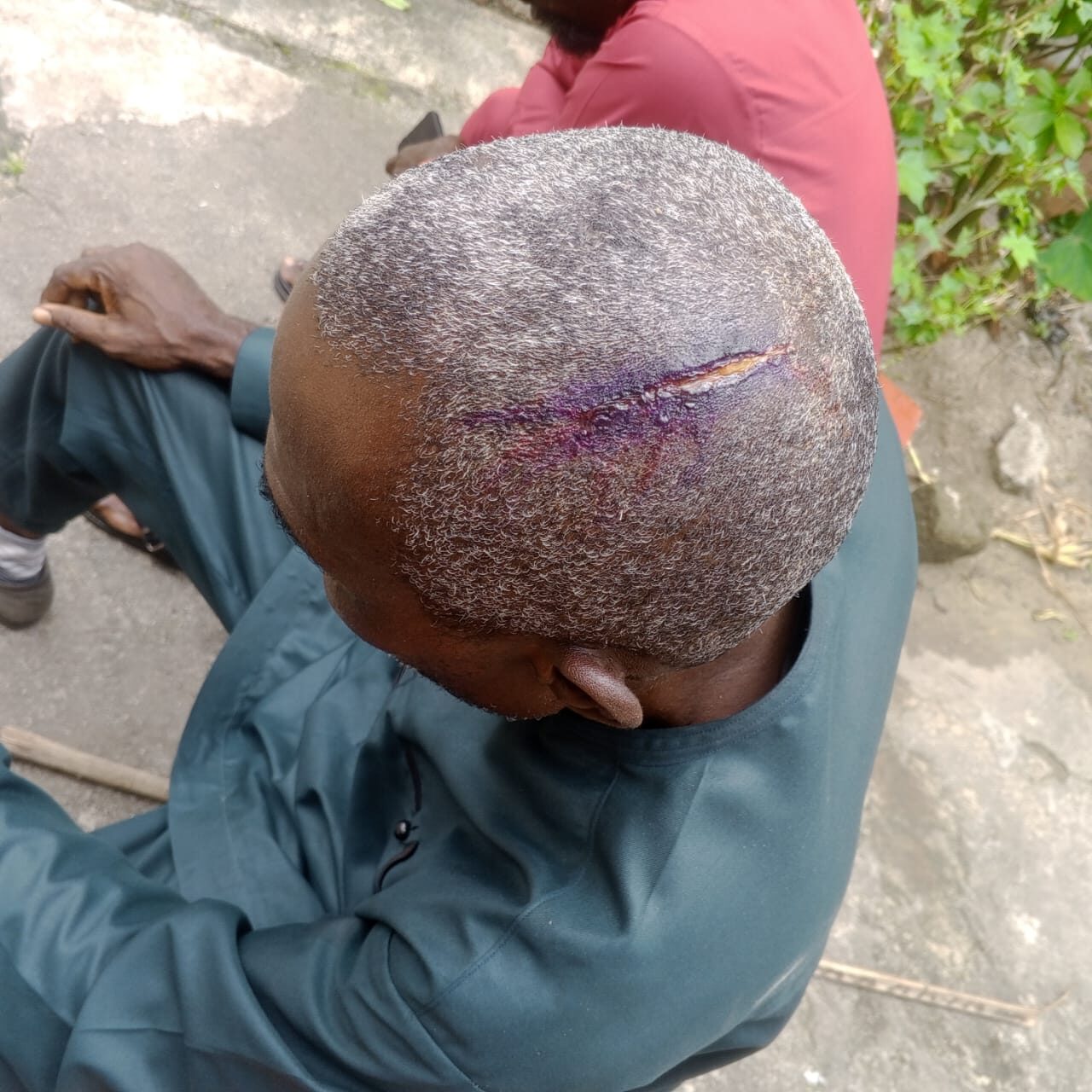 Alleged Penis Theft and Forced Confession in Rivers State